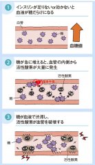 患有糖尿病的人患中風的危险高。